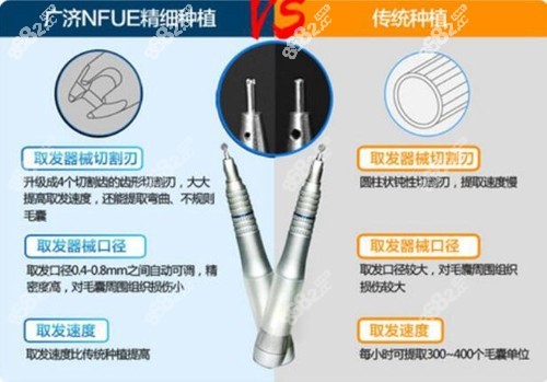 <!--<i data=20240705-sp></i>-->植發(fā)優(yōu)勢介紹