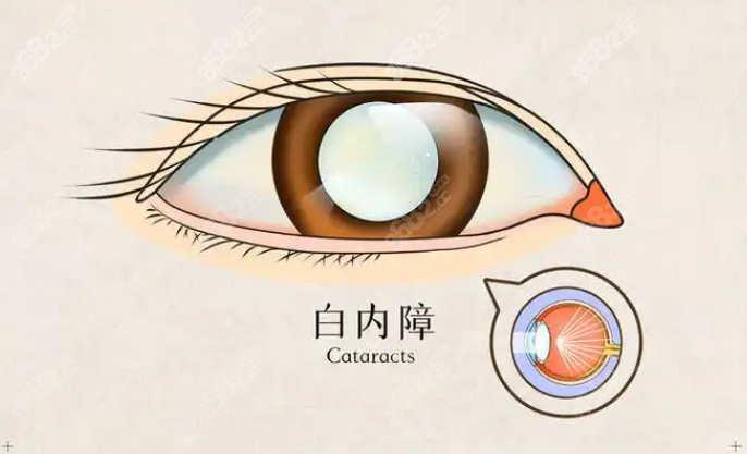 恩施慧宜眼科医院报销怎么办理？慧宜眼科“一站式”服务省心又省力