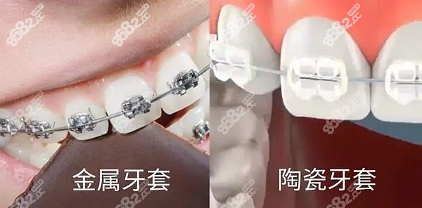 益阳德益口腔价格表