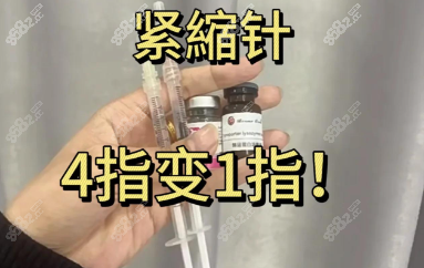 南宁缩紧针