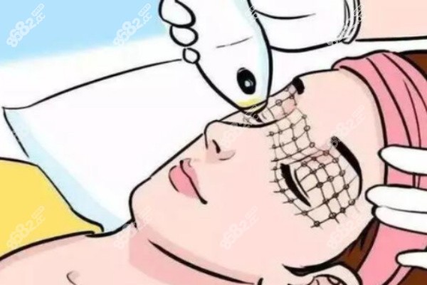 激光除皱科技 激光除皱科技