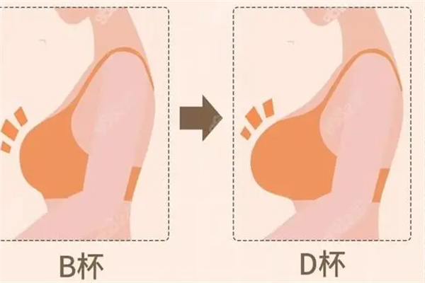 罗盛康医生预约挂号：多途径约深圳艺星/省二院隆胸是一绝