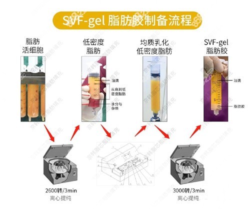 北京京韩的纳米脂肪胶填充