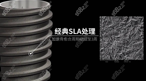 瑞士士卓曼T - ST種植牙表面處理