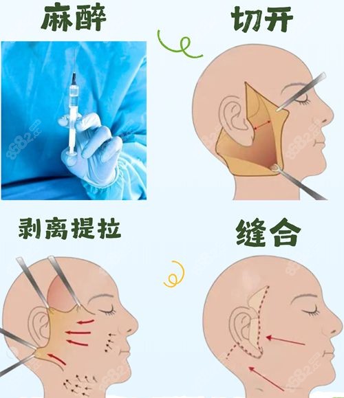 北医三院谢宏彬门诊费用明细