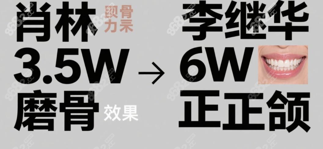 从价格看重庆肖林 VS 李继华 VS 罗恩哪个好