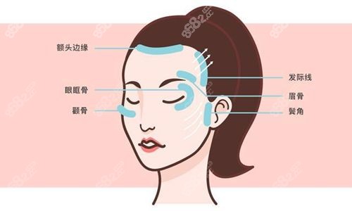 北医三院谢宏彬门诊费用：内窥镜拉皮6万+中面部提升4.8万+