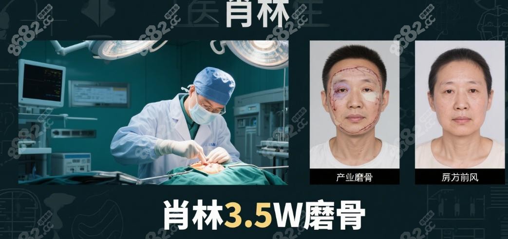 想知道重庆肖林 VS 李继华 VS 罗恩哪个好？先看肖林 3.5W 磨骨实力