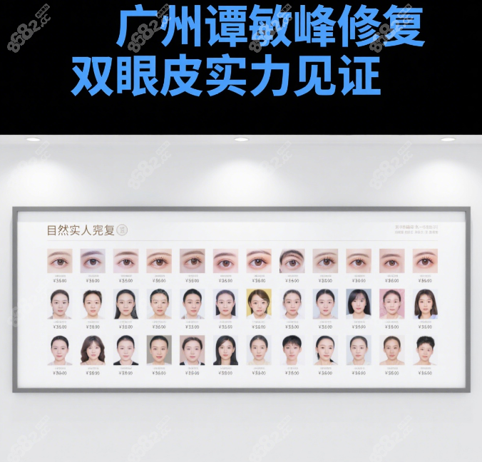 广州谭敏峰修复双眼皮野生实例说话