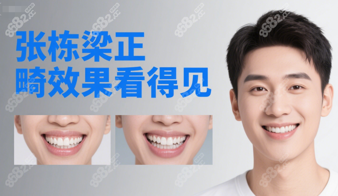 北京正畸圈張棟梁口碑好