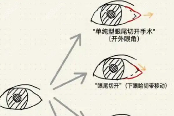 2025年杜园园眼皮