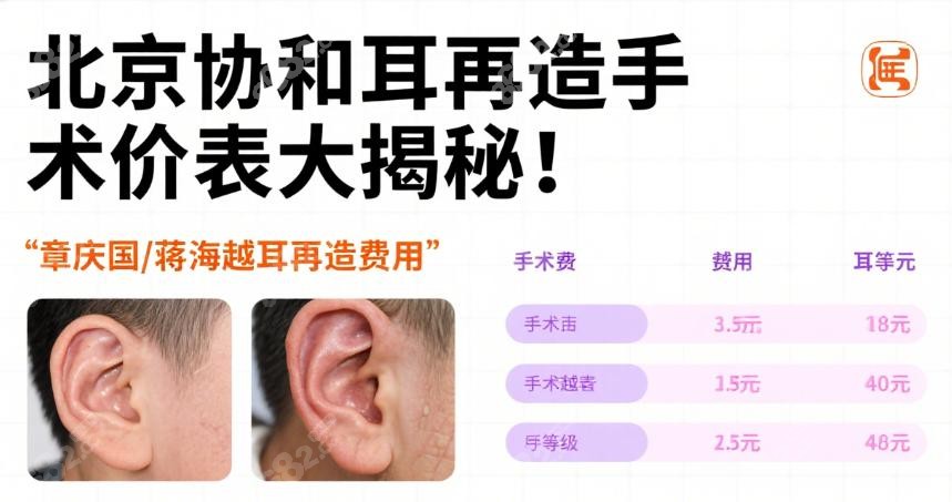 北京协和耳再造手术哪个医生好