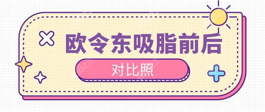 欧令东吸脂前后对比照
