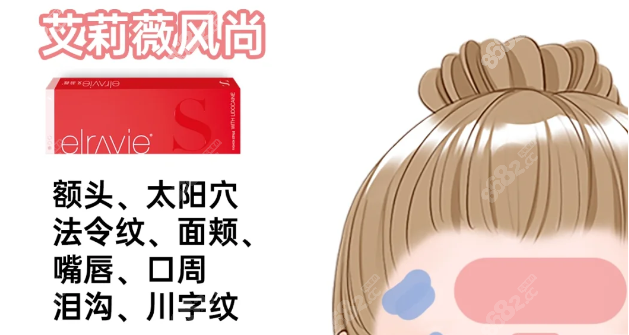 艾莉薇风尚版玻尿酸适合填充哪里