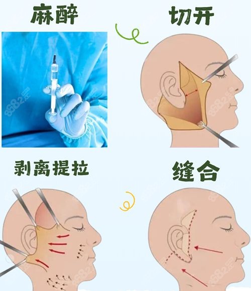 国内拉皮技术好的医生前十名