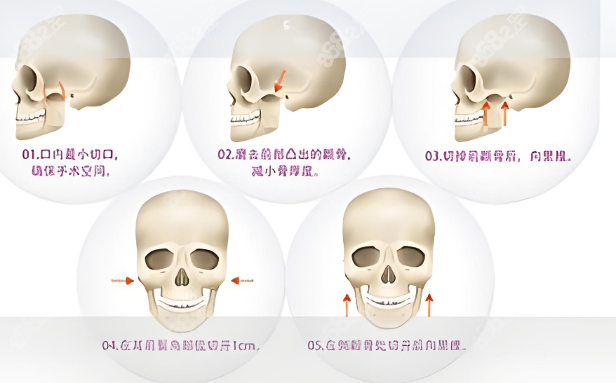 谢宏彬手术前后实例对比www.8682.cc