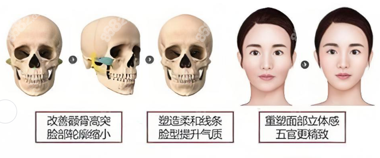 八大处颧骨内推医生预约挂号指南www.8682.cc