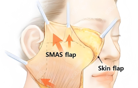怎么預(yù)約謝宏彬醫(yī)生m.66ub.cn