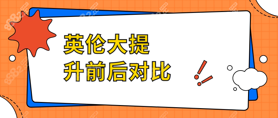 英伦大提升前后对比