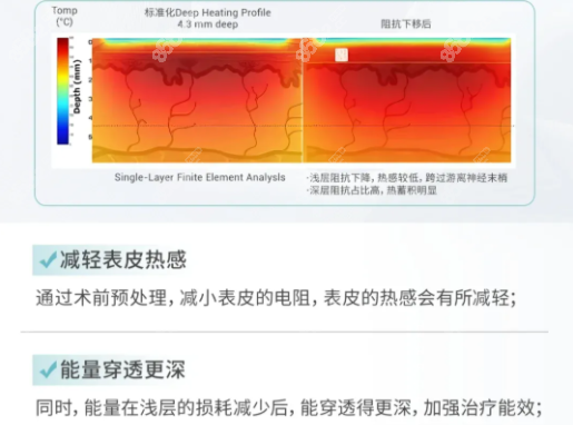 热玛吉