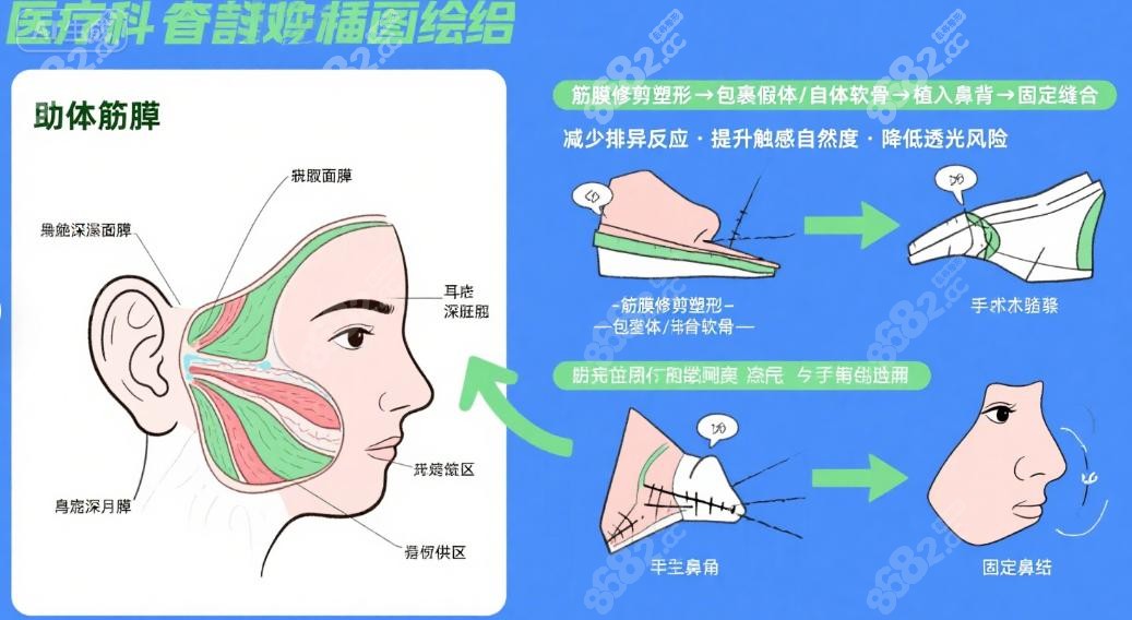 上海华美李健医生做鼻修复怎么样