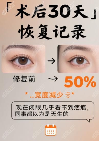 上海郑小红修复眼睛真实评价中的深度解答