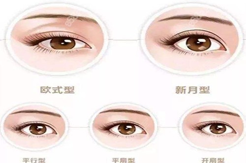 谭敏峰和陈贵宗谁做眼修复好？技术、口碑等优势解读