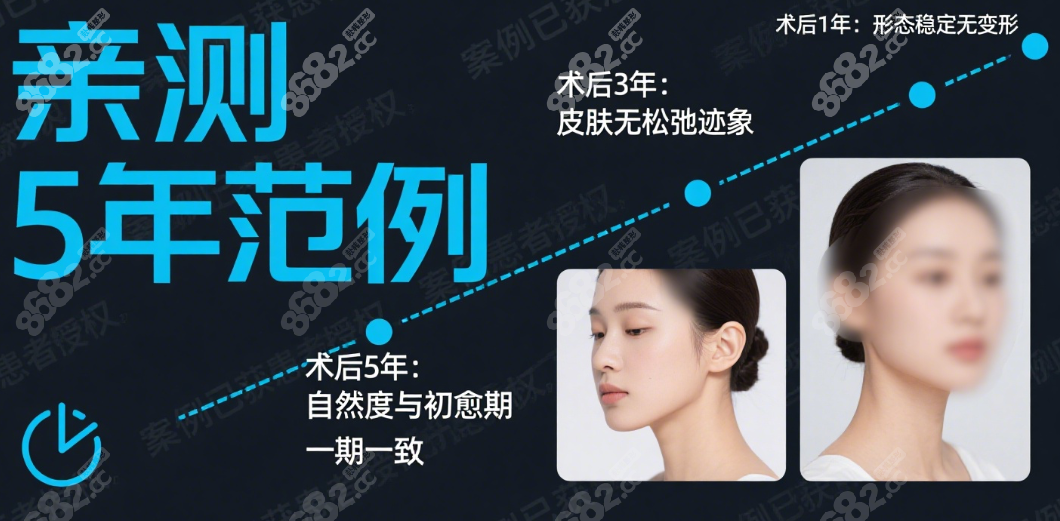 王天国做的鼻子范例