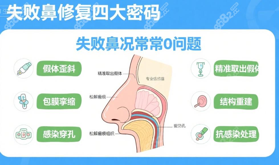 上海华美李健院长失败鼻修复实例剖析