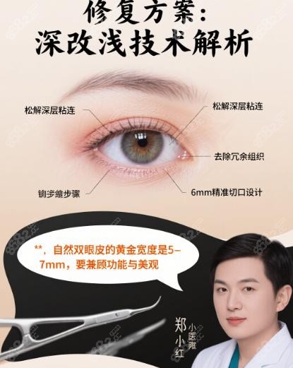 上海郑小红修复眼睛真实评价中的全程守护