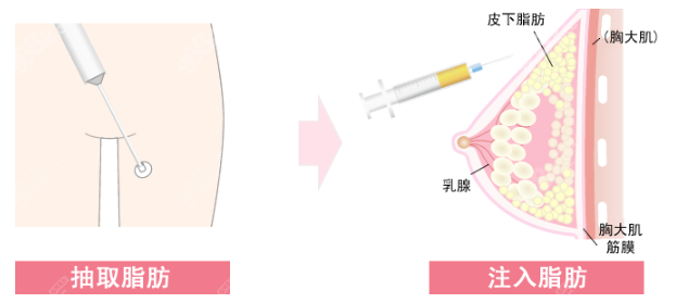 深圳段国新医生联系电话曝光,拨打4008320168预约挂号悬吊手术