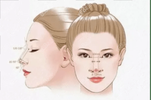 蔣錚錚醫(yī)生輪廓固定示意圖