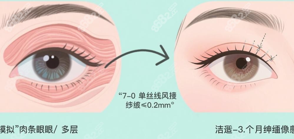 王衡健修复强在哪