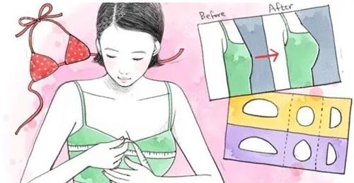 夏建軍和栗勇隆胸技術對比 夏建軍和栗勇隆胸技術對比