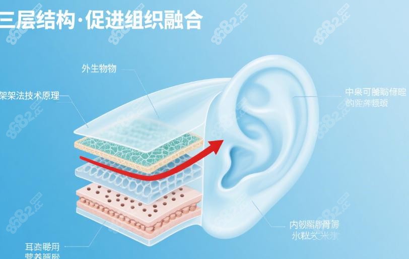 ‌安洪宾耳再造技术深扒:三明治支架法术后耳朵随年龄生长