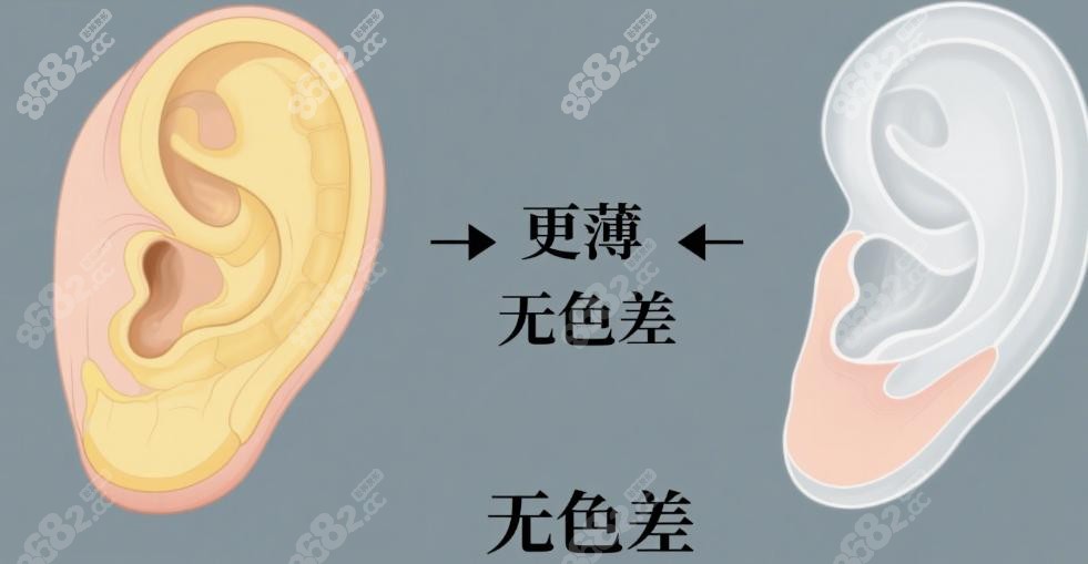 庄洪兴谈生物材料做耳再造:比肋软骨更香,又薄又美观无色差
