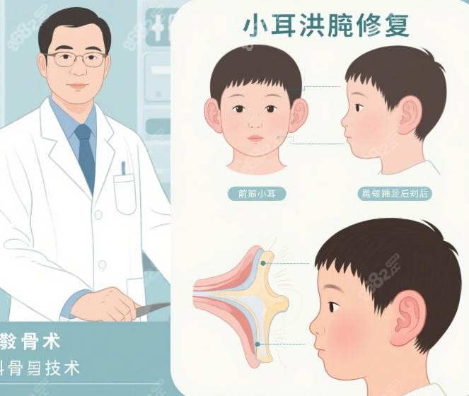 庄洪兴肋软骨采集术：取肋不塌胸的五大核心技术