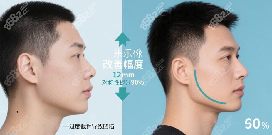 重庆松山朱乐林下颌角修复如何化解“失败”困局 重庆松山朱乐林下颌角修复如何化解“失败”困局
