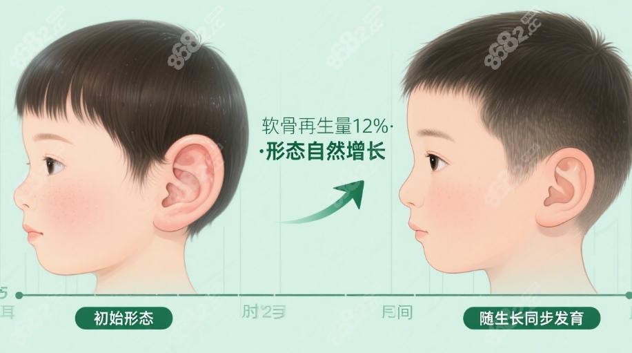 安洪宾耳再造技术VS传统术式