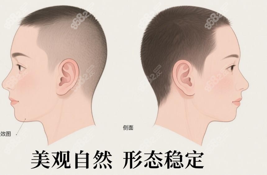 庄洪兴谈生物材料做耳再造是一项高度精细的系统工程