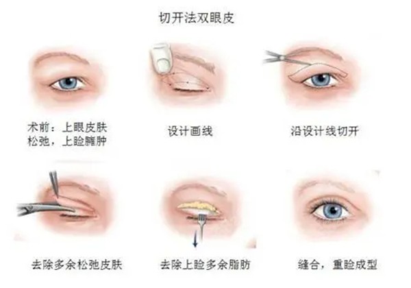 北京双眼皮修复医生排名前十名