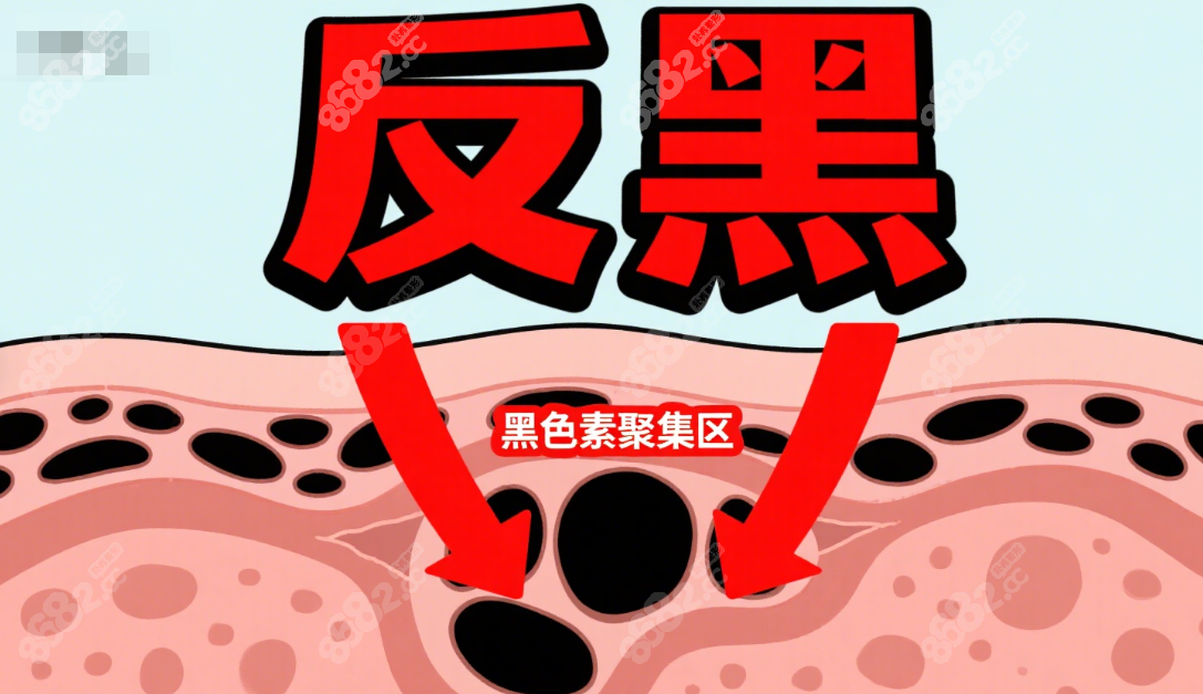 反黑拯救指南