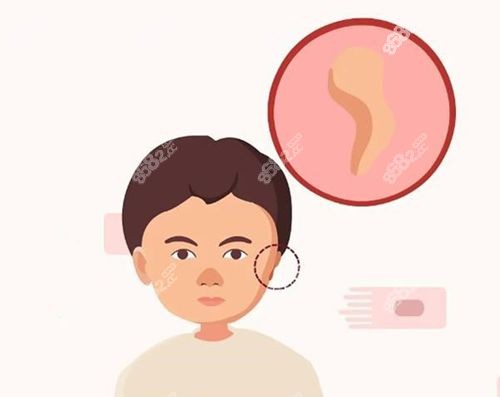 张正文医生耳畸形义诊时间