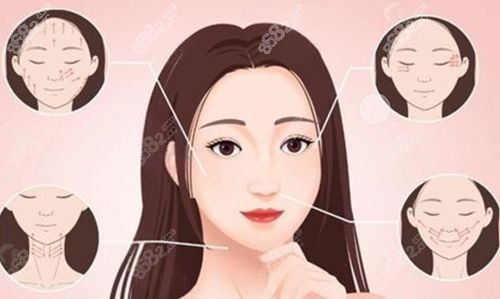 上海赵鹏筋膜悬吊提升做的好