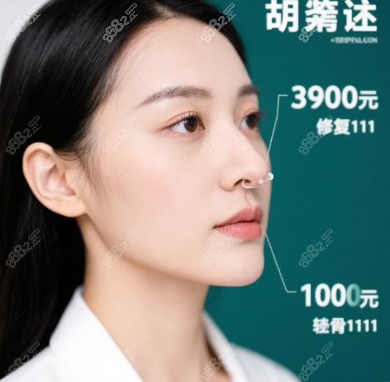 胡志成鼻整形沒有失敗實例
