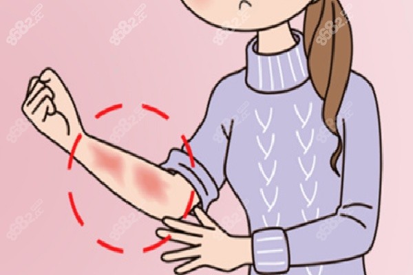 成都疤研疤痕醫(yī)院祛疤價格區(qū)間之具體技術(shù)價格