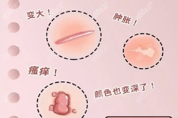 成都疤研疤痕醫(yī)院祛疤好評情況之實際實例見證