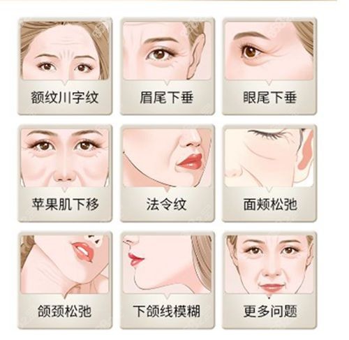 为什么赵鹏筋膜提升价格跨度这么大