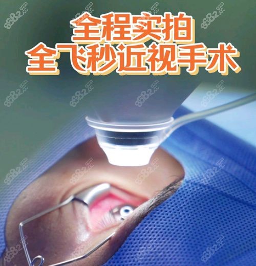 河北省二院眼科全飞秒手术价格全解析