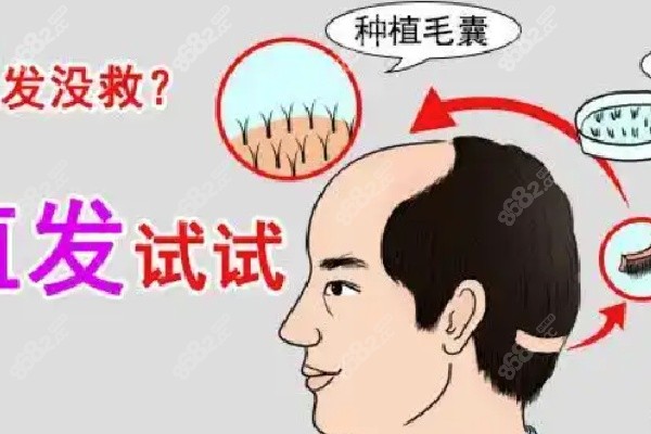 西昌恒美植发机构详情